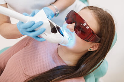How Long Does Teeth Whitening Take?
