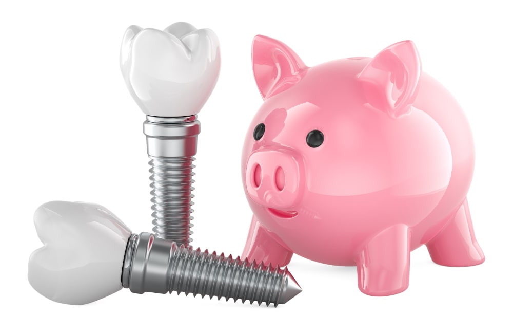 How Much Do Dental Implants Cost in Canada?