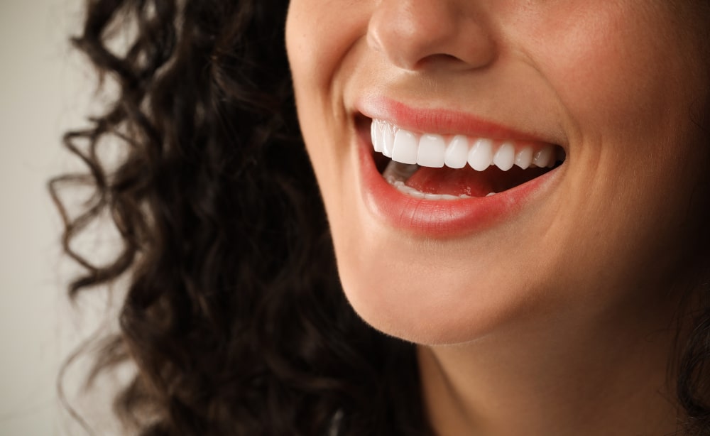 How Much Do Veneers Cost in Pickering?