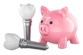 How Much Do Dental Implants Cost in Canada?