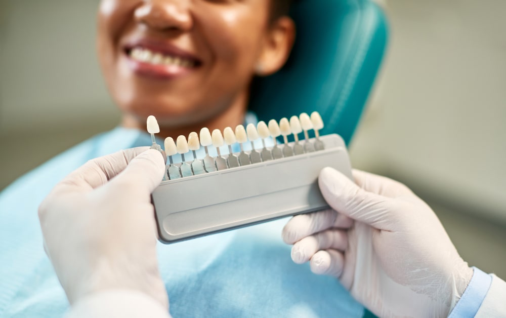 Close-up of dentist matching veneer shade with patient’s natural teeth
